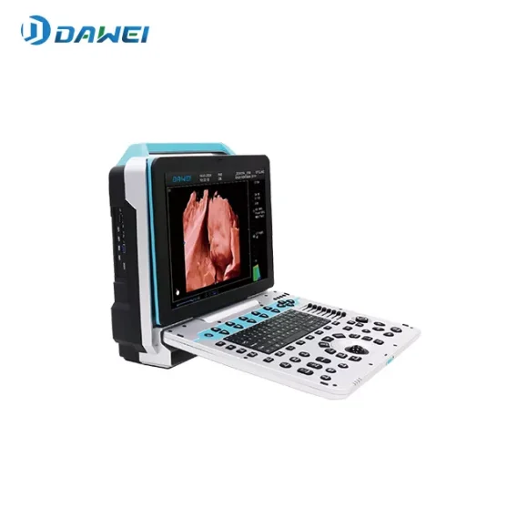 Máquina de ultrasonido 4D portátil para la salud de las mujeres