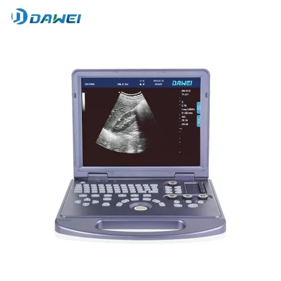 Máquina de ultrasonido B/W portátil con función PW