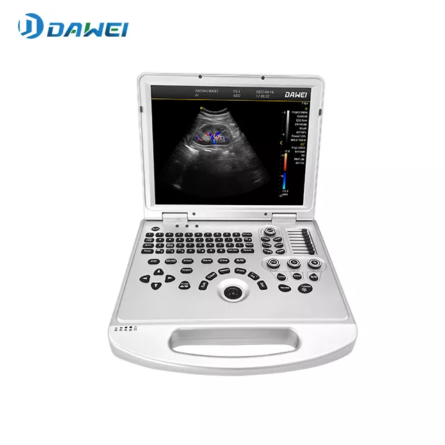 01-punto-de-cuidado-color-portable-escanno-de-ultrasound.webp