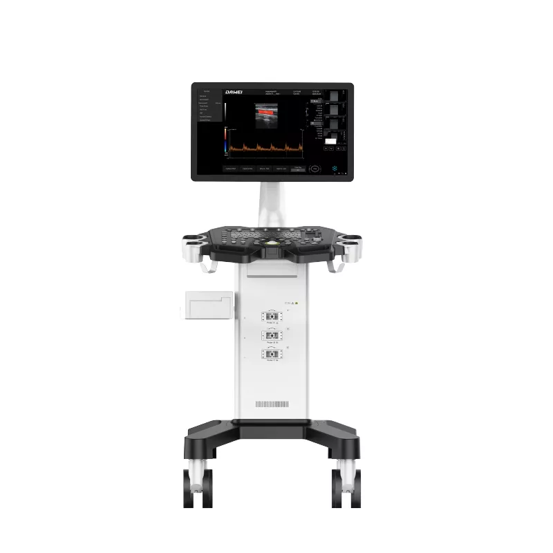 02-equipo-de-ultrasonido-doppler-de-color-de-carrito-barato.webp