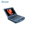 02-maquina-de-ultrasonido-ob-y-gyn-color-portatil.webp