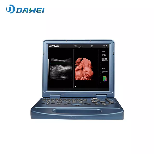 03-maquina-de-ultrasonido-ob-y-gyn-color-portatil.webp