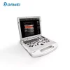 03-punto-de-cuidado-color-portable-escanno-de-ultrasound.webp