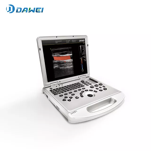 03-punto-de-cuidado-color-portable-escanno-de-ultrasound.webp