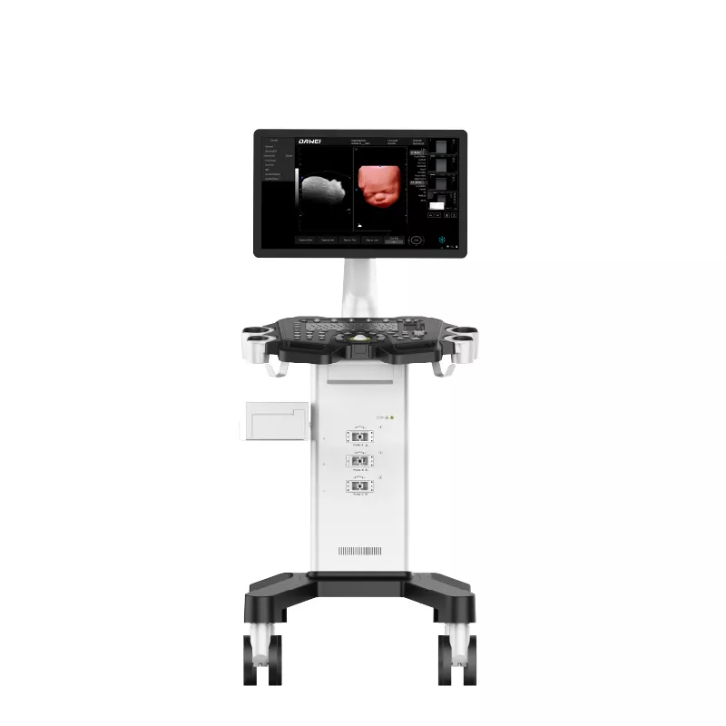 04-equipo-de-ultrasonido-doppler-de-color-de-carrito-barato.webp