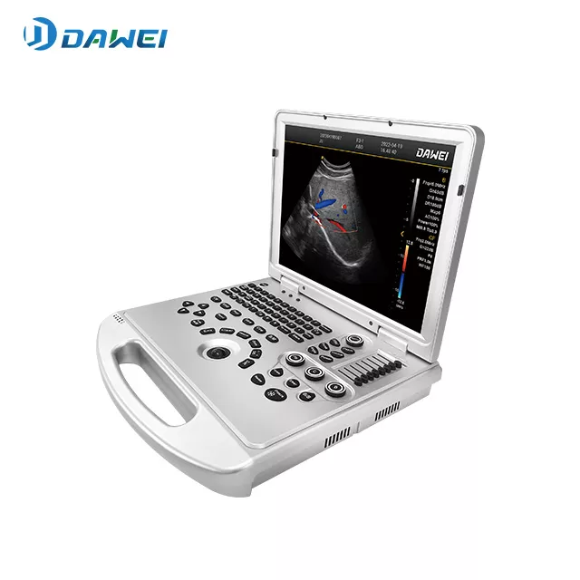 05-punto-de-cuidado-color-portable-escanno-de-ultrasound.webp